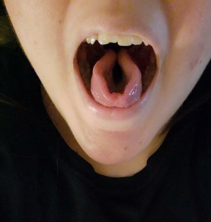 I Can Fold My Tongue Inward To Create This Cool Star/Diamond Shape