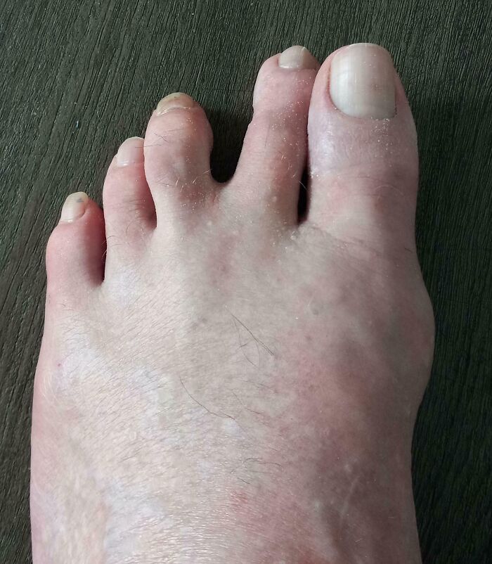 My Toes Make The Spock Salute