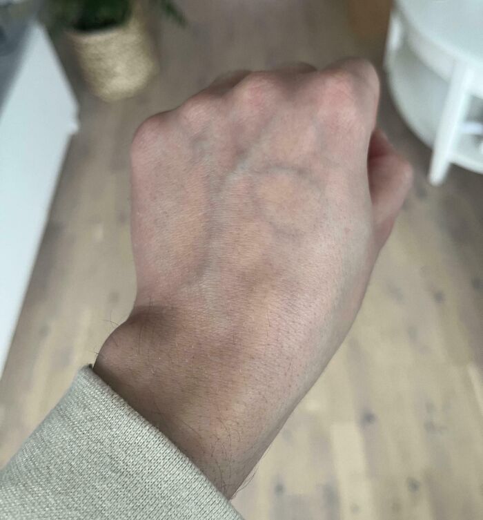 My Veins Spell Out “Yo”