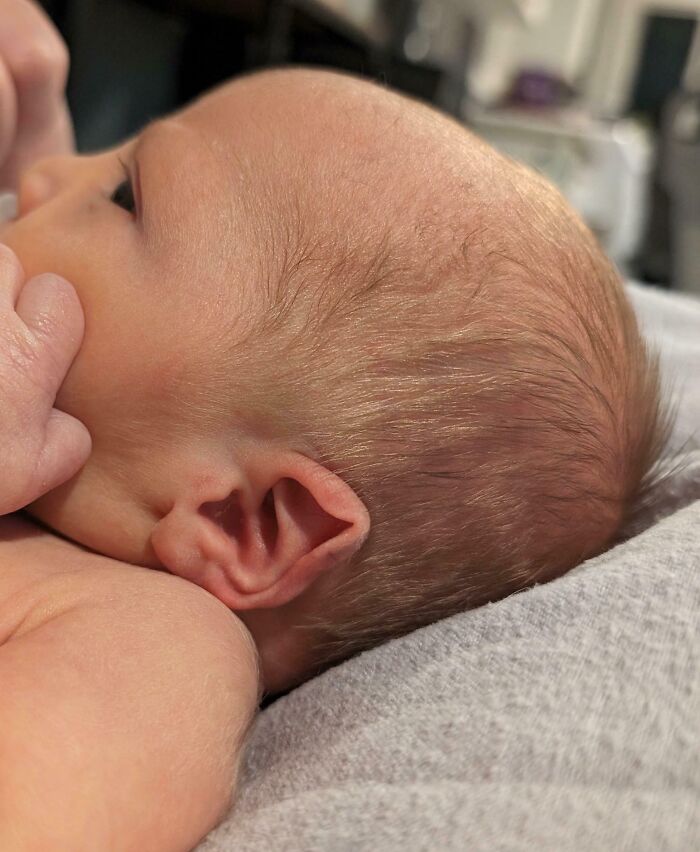 My Son Was Born With Elf Ears