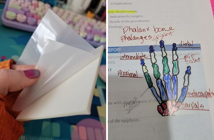 Left hand peeling a white peel-off sticker, right side shows a labeled hand bone diagram of phalanx and metacarpals.