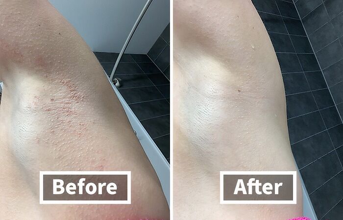 Ashy Isn’t A Good Look On Anyone So Try The Vanicream Moisturizing Skin Cream Instead