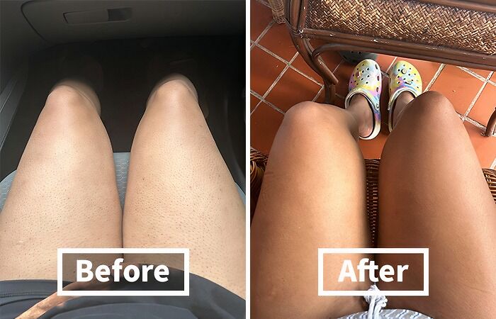 This KP Bump Eraser Body Scrub Will Have Your Skin Smooth And Silky, Ready For Summer! 