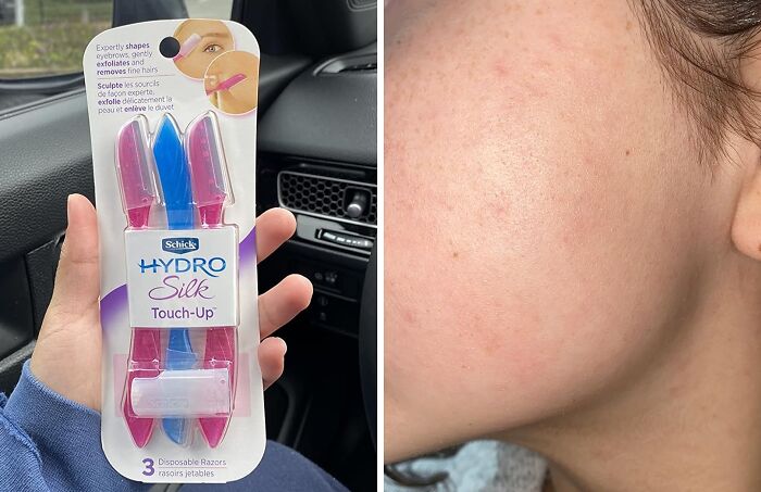 Peach Fuzz Will Be A Thing Of The Past With This Dermaplaning Tool With A Precision Cover 