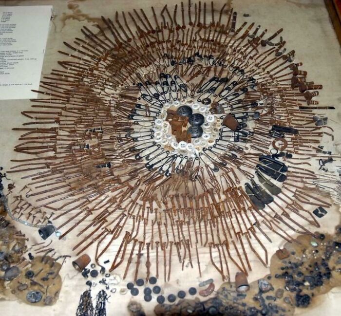 The Stomach Contents Of A Psychiatric Patient Who Suffered From Pica Disorder, A Disease Characterized By An Appetite For Inedible Objects