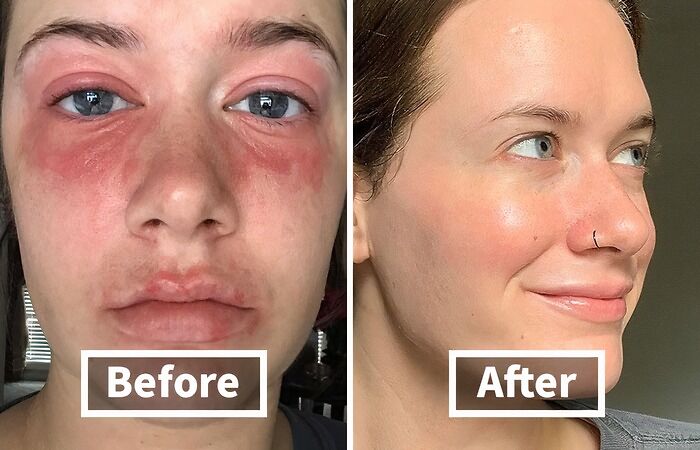 This Hydrating Serum Will Take You From Thirsty To Thirstrap In No Time 