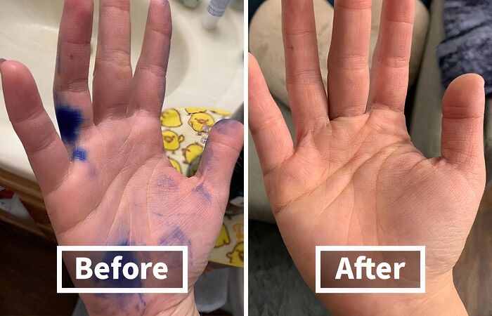 You Don't Have To Show The Whole World That You Are An At-Home Color Artist. Use These Hair Dye Remover Wipes To Clean Up Any Messy Spots