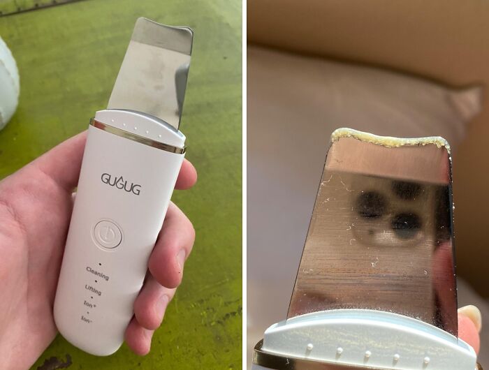 Your Beauty Routine Just Got A Tech Upgrade With This Face Spatula Pore Cleaner 