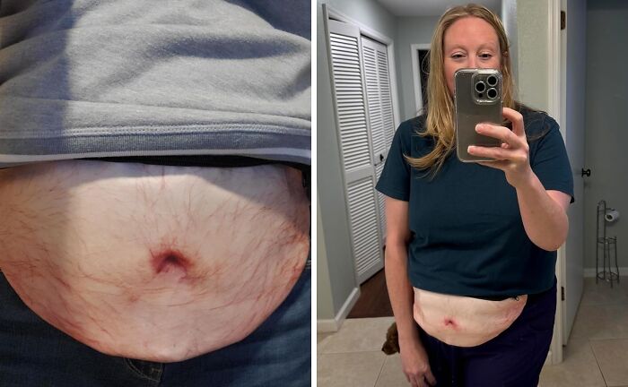 This Belly Pack Turns The Dad Bod Into High Fashion