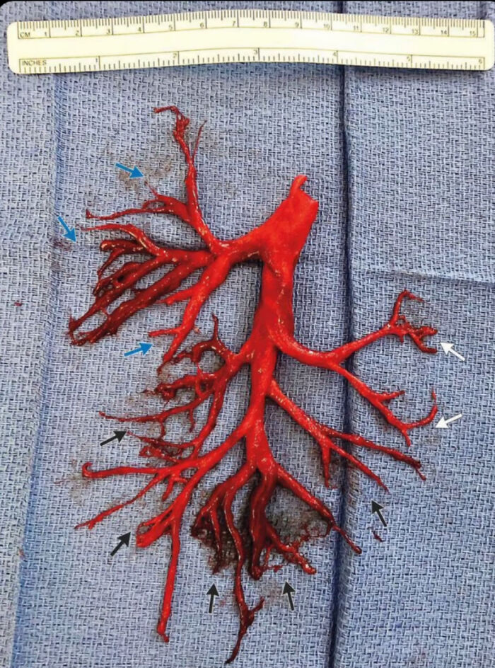 Estructura roja sobre tela azul, acompañada de regla, creando una imagen extrañamente aterradora.