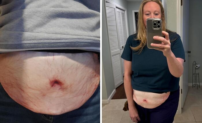 Let's See Someone Trying To Pickpocket You With This Belly Pack