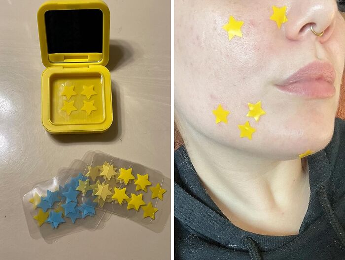 Say Goodbye To Pesky Pimples With Pimple Patches