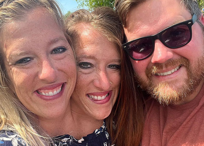 Conjoined Twin Abby Hensel Finally Shares Photos From Wedding To US Army Veteran