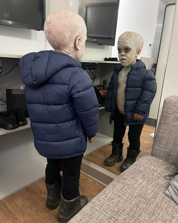 Boy With Dwarfism Delights In “Furiosa” After Going Viral For Heartbreaking Response To Bullies Boy With Dwarfism Delights In “Furiosa” After Going Viral For Heartbreaking Response To Bullies