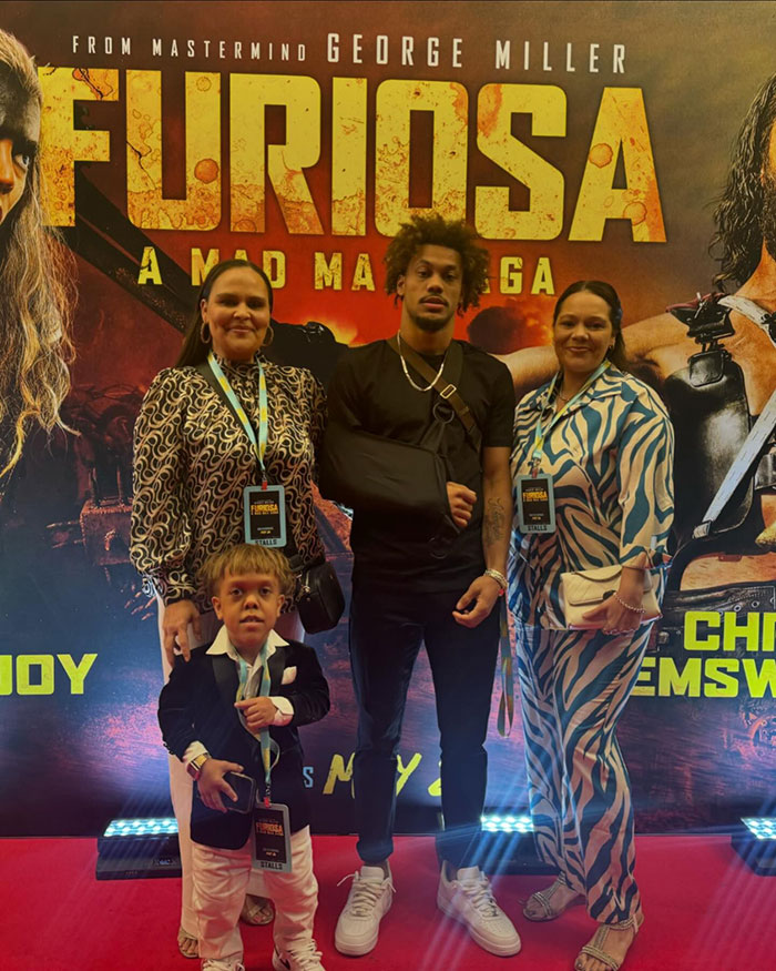Boy With Dwarfism Delights In “Furiosa” After Going Viral For Heartbreaking Response To Bullies Boy With Dwarfism Delights In “Furiosa” After Going Viral For Heartbreaking Response To Bullies