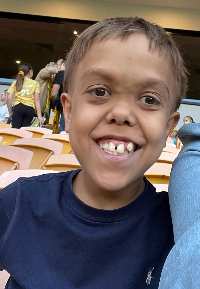 Boy With Dwarfism Delights In “Furiosa” After Going Viral For Heartbreaking Response To Bullies Boy With Dwarfism Delights In “Furiosa” After Going Viral For Heartbreaking Response To Bullies