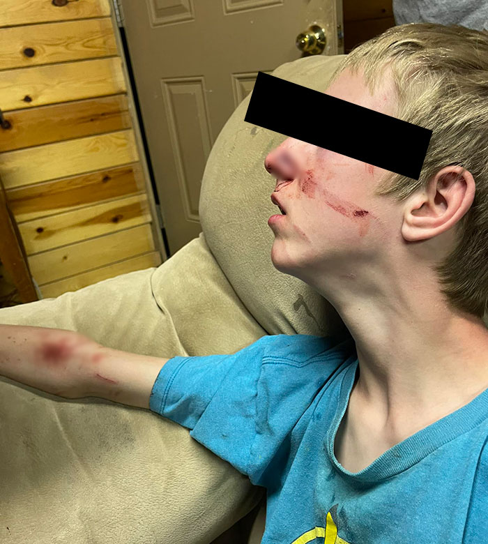 15-Year-Old Boy With Neurological Disorder Mauled By Bear While Watching TV