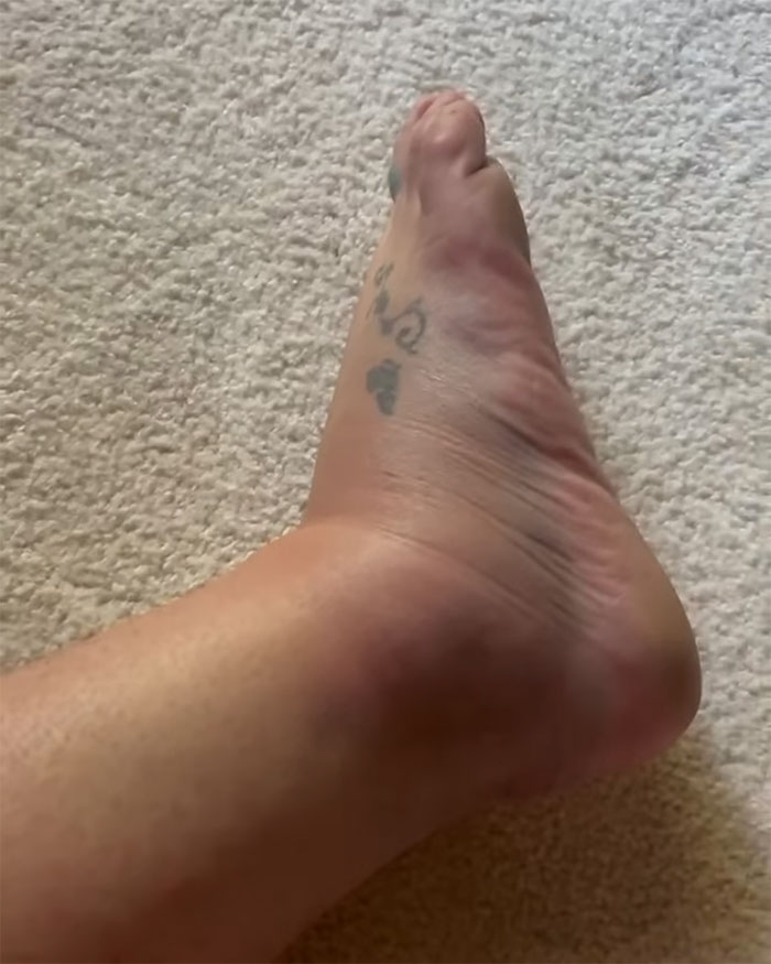 &ldquo;I Felt Completely Harassed&rdquo;: Britney Spears Slams Paramedics Amid Chateau Marmont Chaos