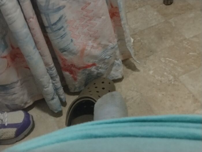 Our Pet Soft Can-Opener, Wearing Blue Fur On Her Peets