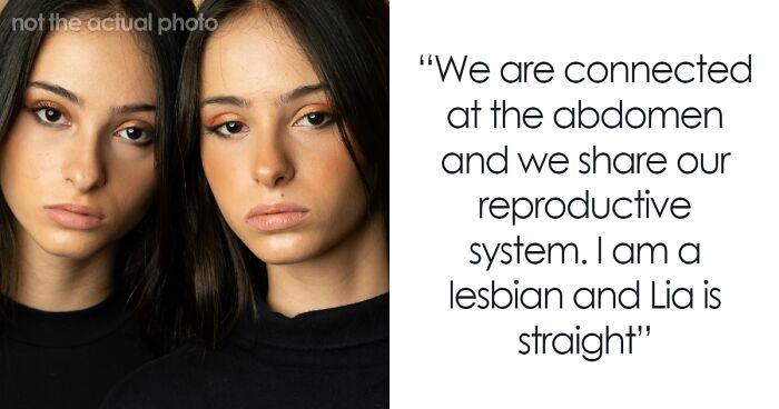 “Feels Like Someone Messing With Your Body”: Conjoined Twin Shares Intimate Lifestyle Details