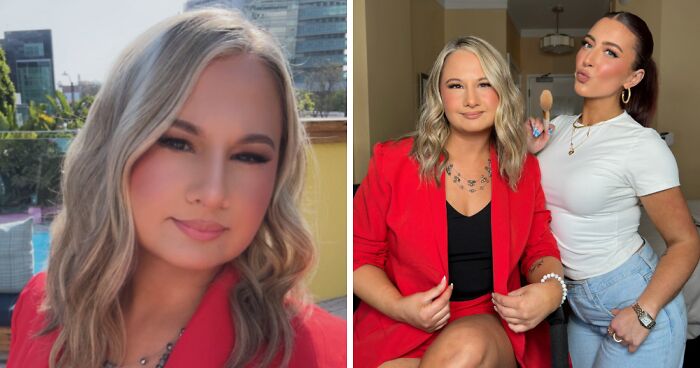 Gypsy Rose Blanchard, Who “Wanted A More Feminine-Looking Nose,” Flaunts New Look After Nose Job