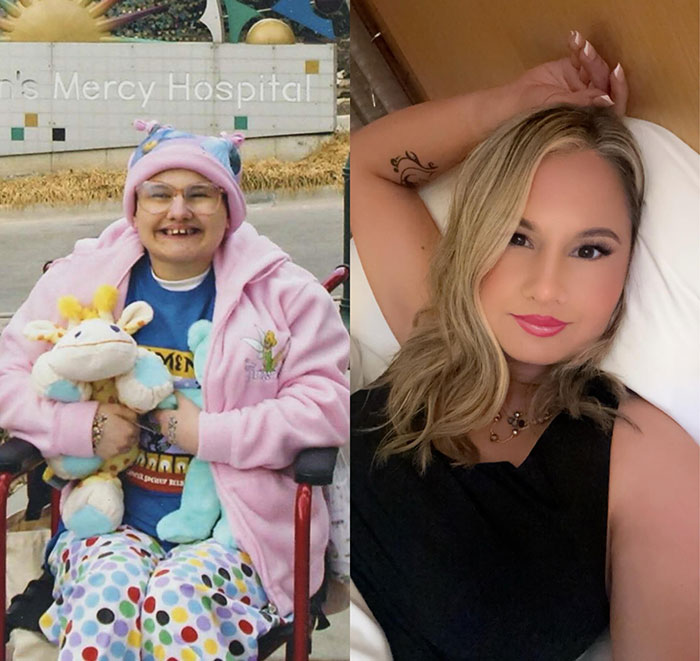 Gypsy Rose Blanchard in two contrasting images, highlighting transformation over time.