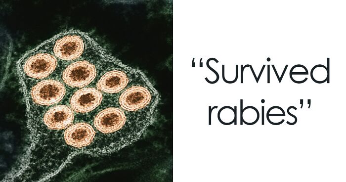 “Only 12 People Have Walked On The Moon. What’s Something That Less People Have Done?” (30 Stories)