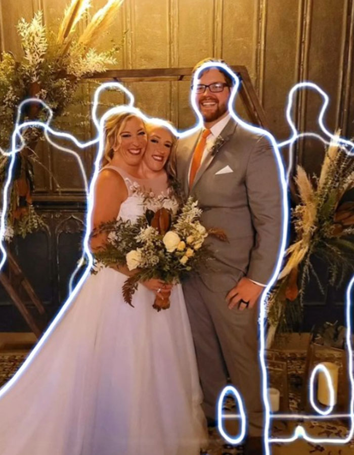 Conjoined Twin Abby Hensel Finally Shares Photos From Wedding To US Army Veteran