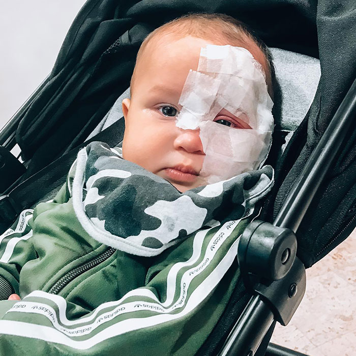 Trolls Called This Mom A &ldquo;Monster&rdquo; For Lasering Off Son&rsquo;s Birthmark&mdash;Now She&rsquo;s Making A Difference