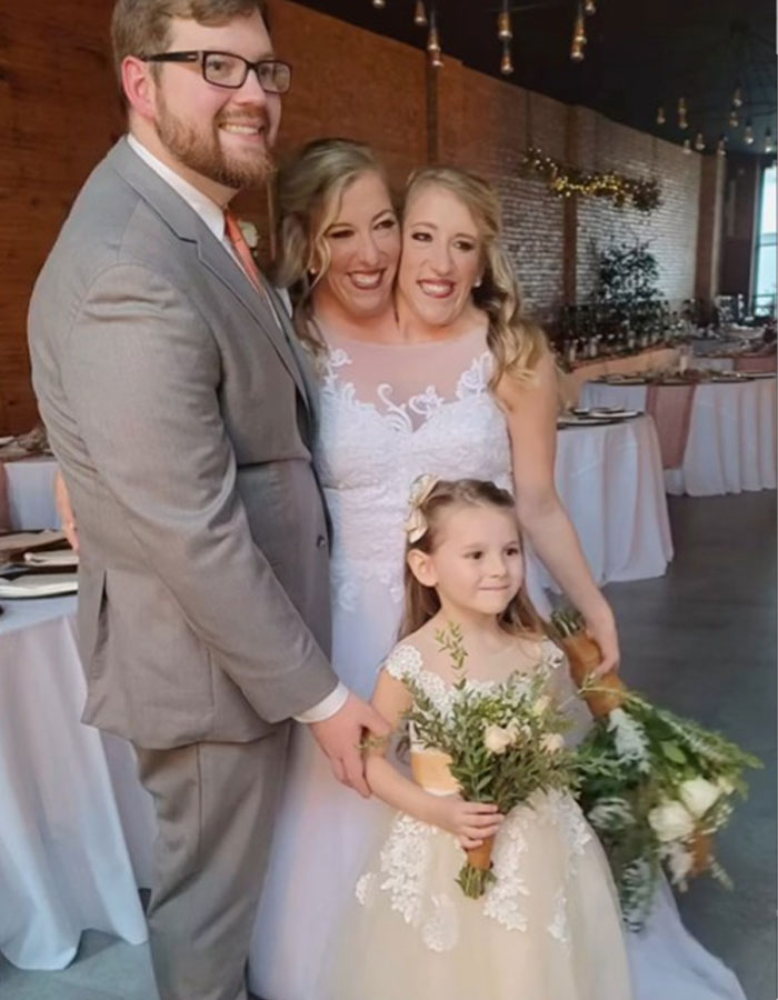 Conjoined Twin Abby Hensel Finally Shares Photos From Wedding To US Army Veteran
