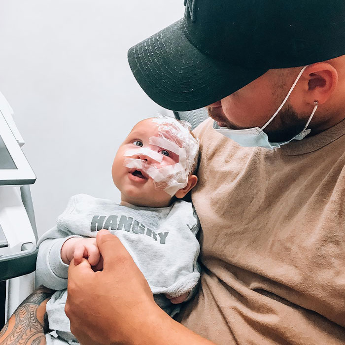 Trolls Called This Mom A &ldquo;Monster&rdquo; For Lasering Off Son&rsquo;s Birthmark&mdash;Now She&rsquo;s Making A Difference