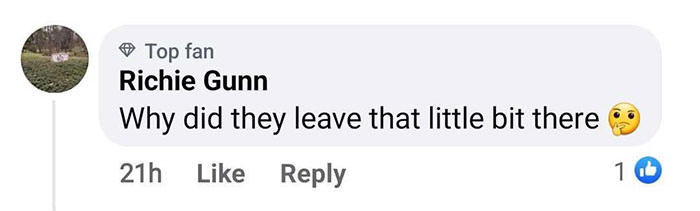 Surgeons Finally Remove 15-Lb Tumor From Man&rsquo;s Scalp After 25 Years