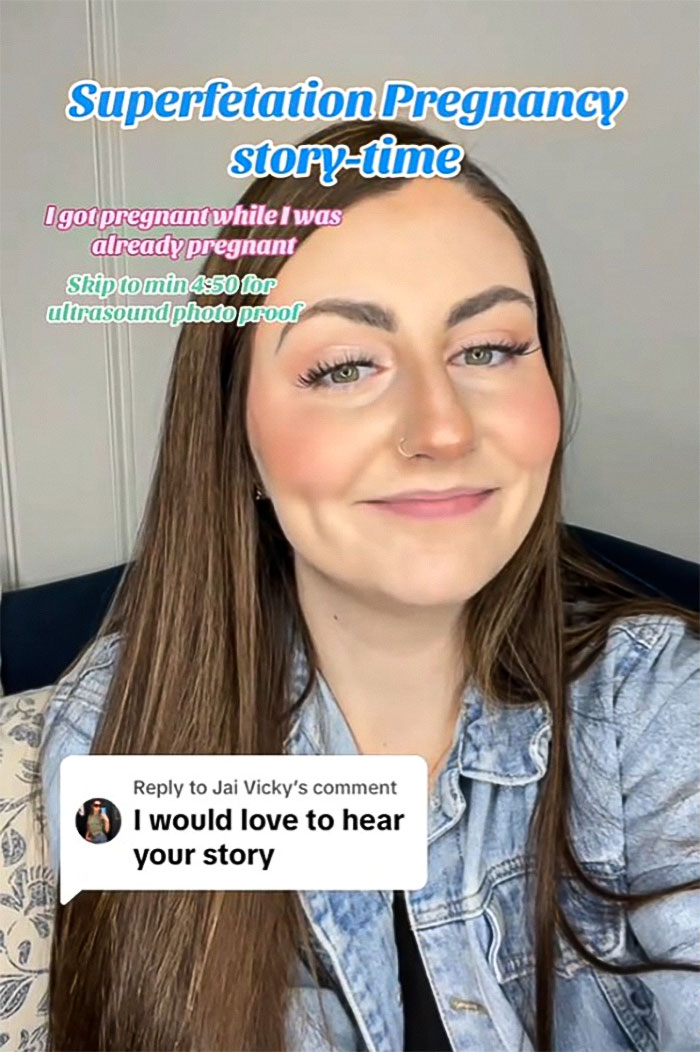 Health Professionals Stunned By Mother's "Superfetation" Pregnancy Health Professionals Stunned By Mother's "Superfetation" Pregnancy