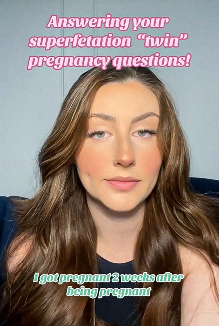 Health Professionals Stunned By Mother's "Superfetation" Pregnancy Health Professionals Stunned By Mother's "Superfetation" Pregnancy