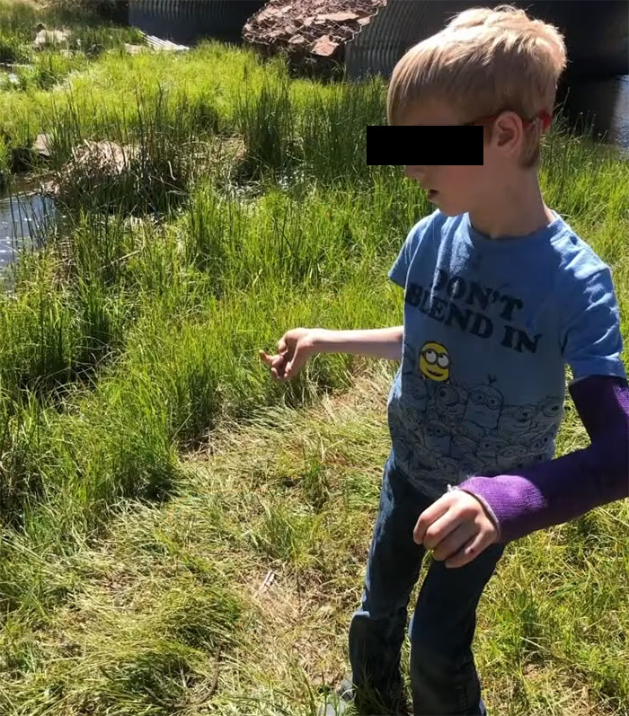 15-Year-Old Boy With Neurological Disorder Mauled By Bear While Watching TV