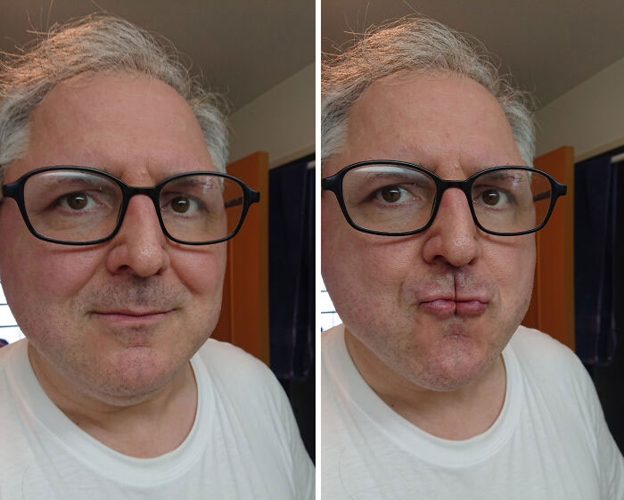 I'm Able To Make It Look Like I Have Two Sets Of Small Lips