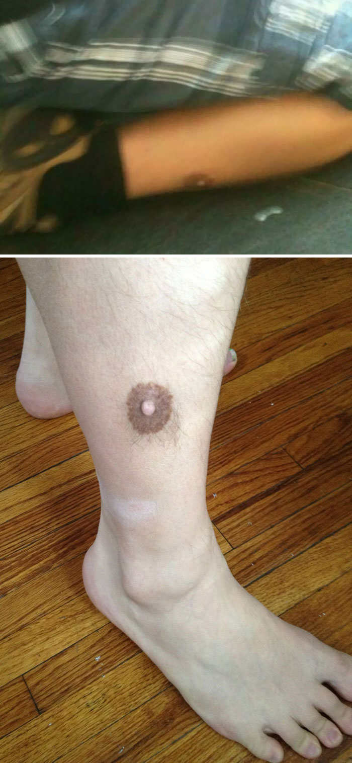 My Friend Kept Telling Me That One Of His Coworkers Had A Nipple On His Leg. I Said I Would Never Believe Him Unless He Got A Picture Of It. He Finally Was Able To Sneak A Photo