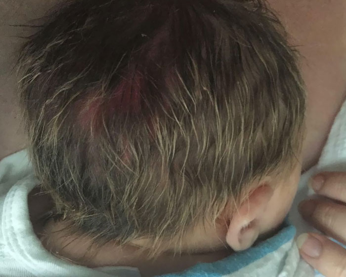 My Daughter Was Born With Highlights