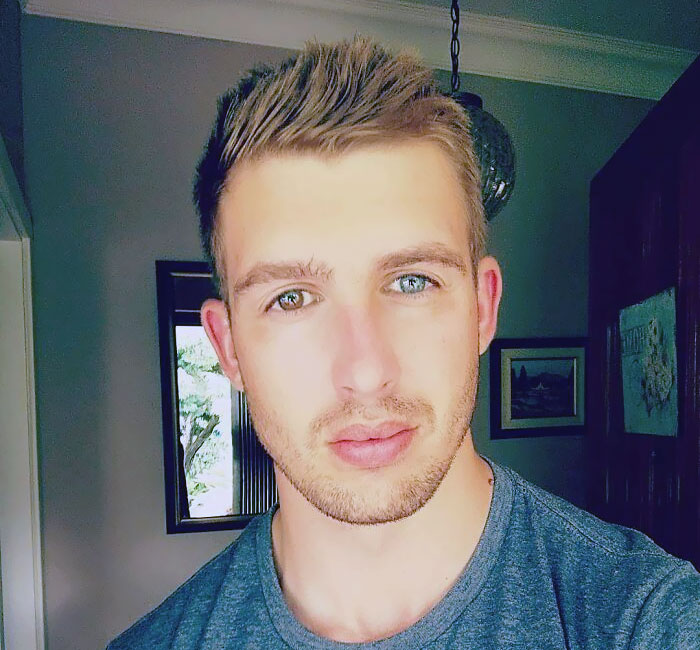 Born With Blue Eyes, But They Changed Into 3 Colors As I Aged