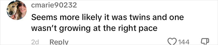 Health Professionals Stunned By Mother's "Superfetation" Pregnancy Health Professionals Stunned By Mother's "Superfetation" Pregnancy