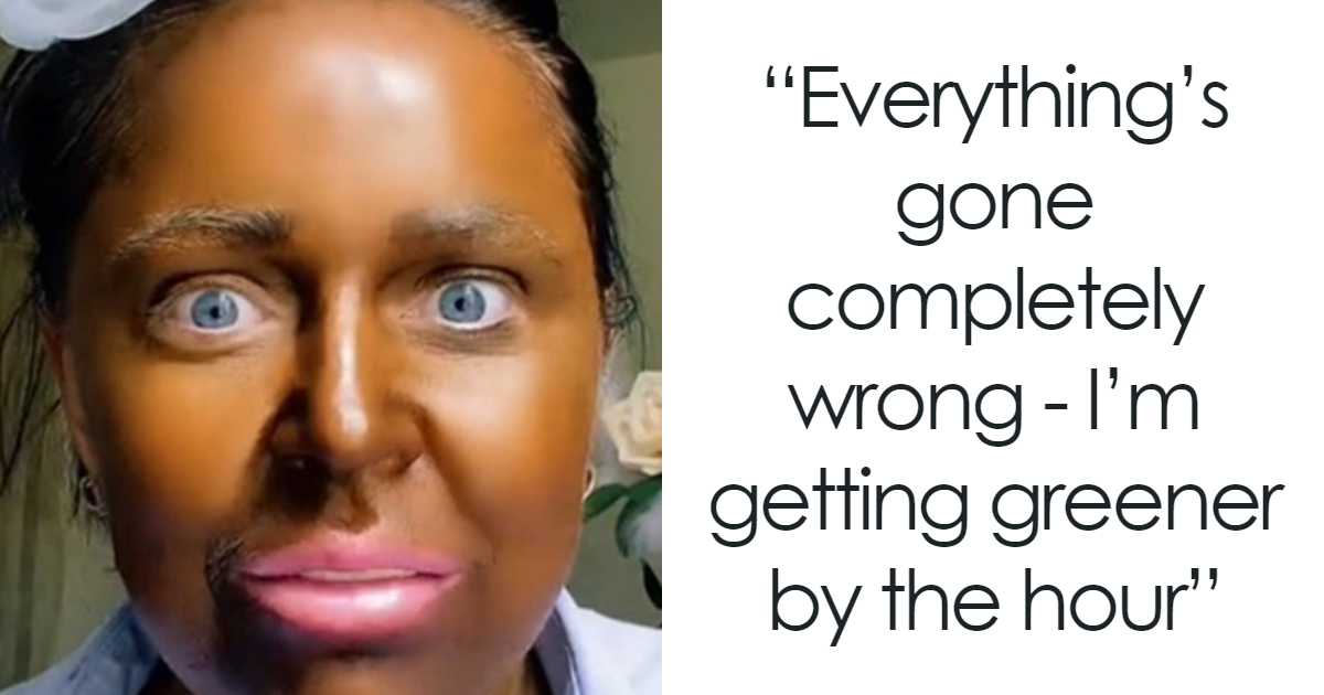 “Why On Earth Did You Use So Many?“: People Stunned After Woman’s Fake Tan Turns Green