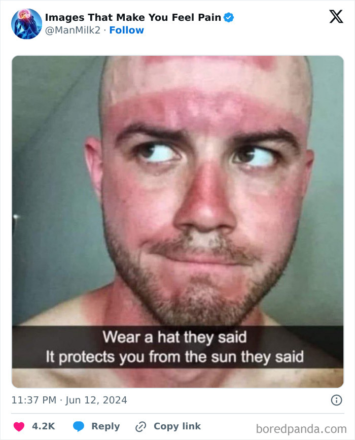 Make-You-Feel-Pain-Images