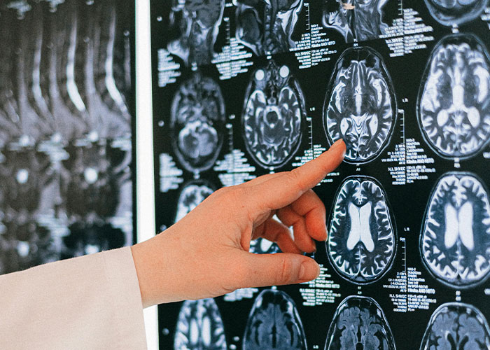 30 People Share What Happened To Their High School’s “Most Likely To Succeed” Student