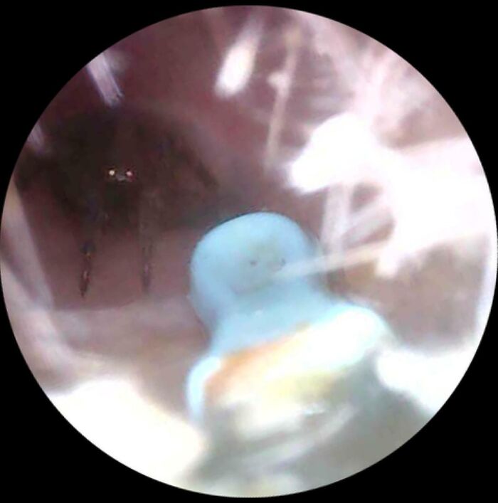 Araña que intentó hacer un nido en mi oreja