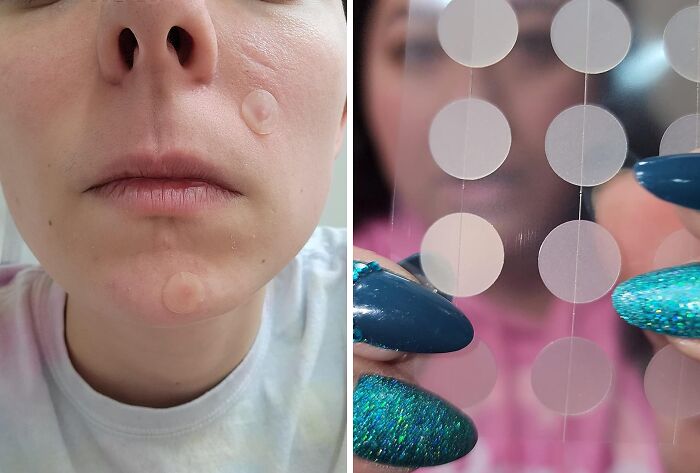  Hero Cosmetics Mighty Patch: The Overnight Pimple Shrink-Inator