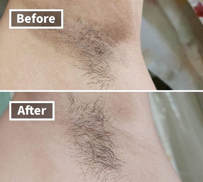 Before and after images showing an underarm hair grooming product for people who want to nail adulting.