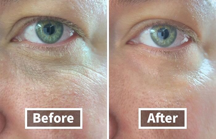 Close-up of a person's eye area showing skin improvement before and after, highlighting adulting skincare finds.