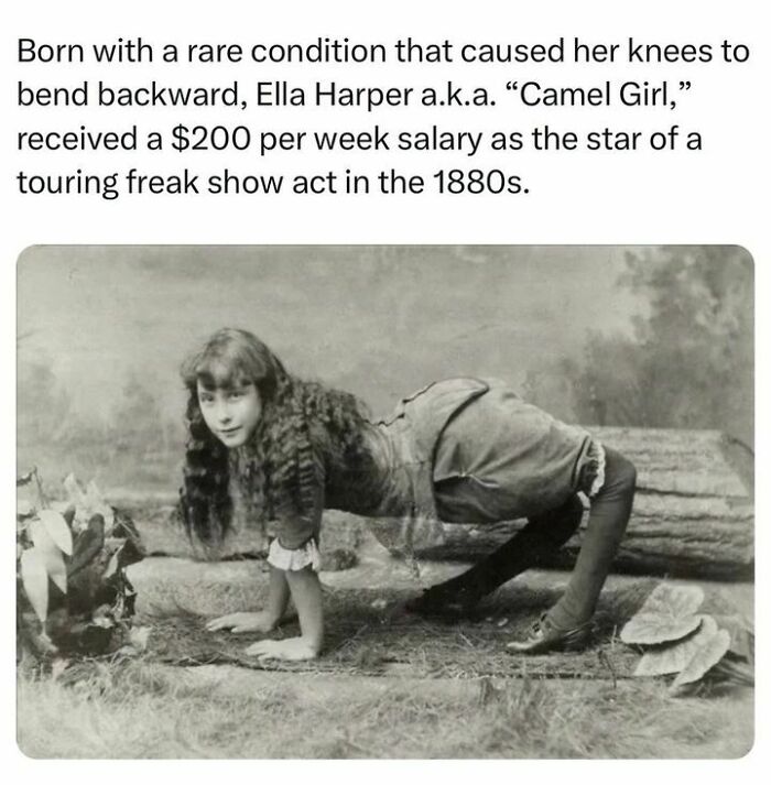 Born With A Rare Condition That Caused Her Knees To Bend Backward, Ella Harper A.k.a. “Camel Girl,” Received A $200 Per Week Salary As The Star Of A Touring Freak Show Act In The 1880s. #didyouknow #facts #historyfacts #explore #interesting