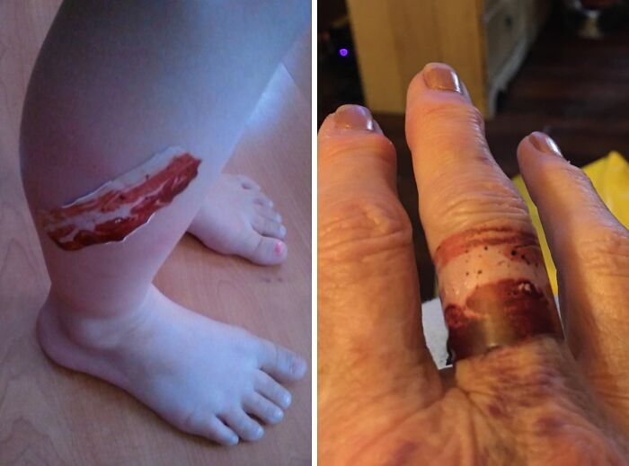 Add Some Sizzle To Your First-Aid Kit With Bacon Strips Bandages, The Tastiest Way To Heal Your Boo-Boos