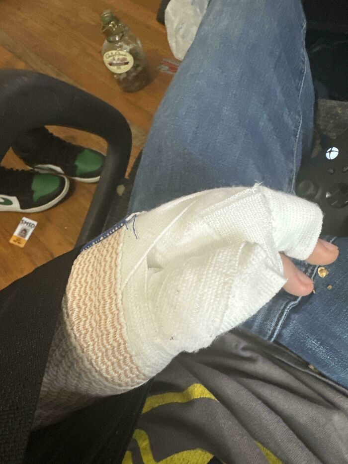 Broke My Hand And Doctors Are Acting Like It’s Nothing